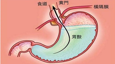 为什么胃酸不会把胃消化掉？