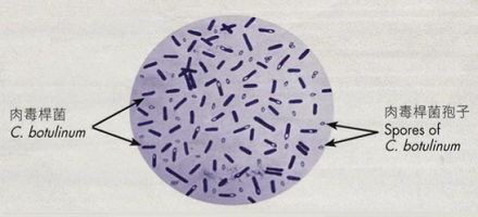 明明 100℃ 就能沸腾，灭菌为什么要 121℃？